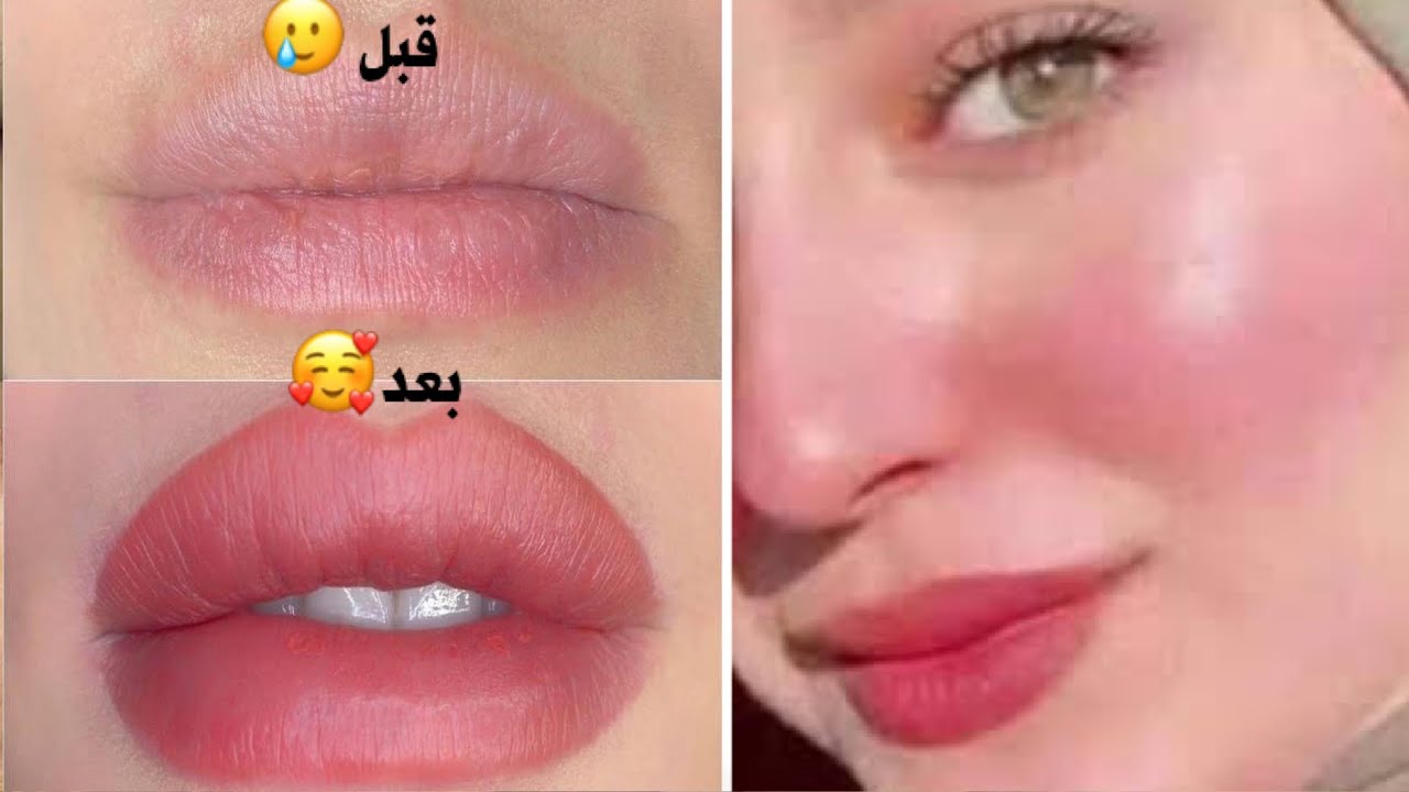“ابتسامتك هتكون حكاية” جربي وصفات ترطيب الشفايف فى المنزل بمكونات طبيعية وآمنة 100% والنتيجة هتبهرك من أول استعمال!